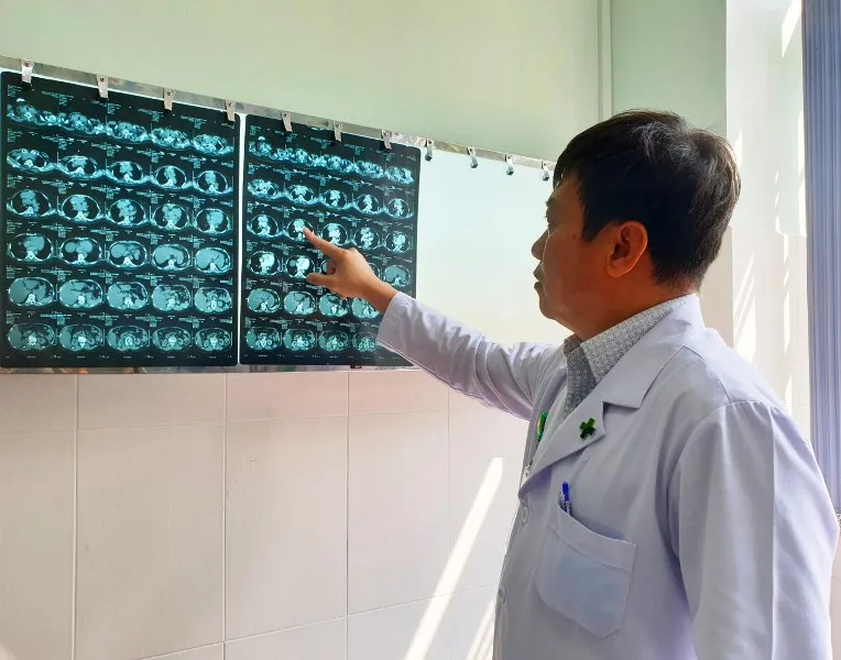 Phẫu thuật thành công bướu giáp thòng từ cổ xuống ngực ảnh 2