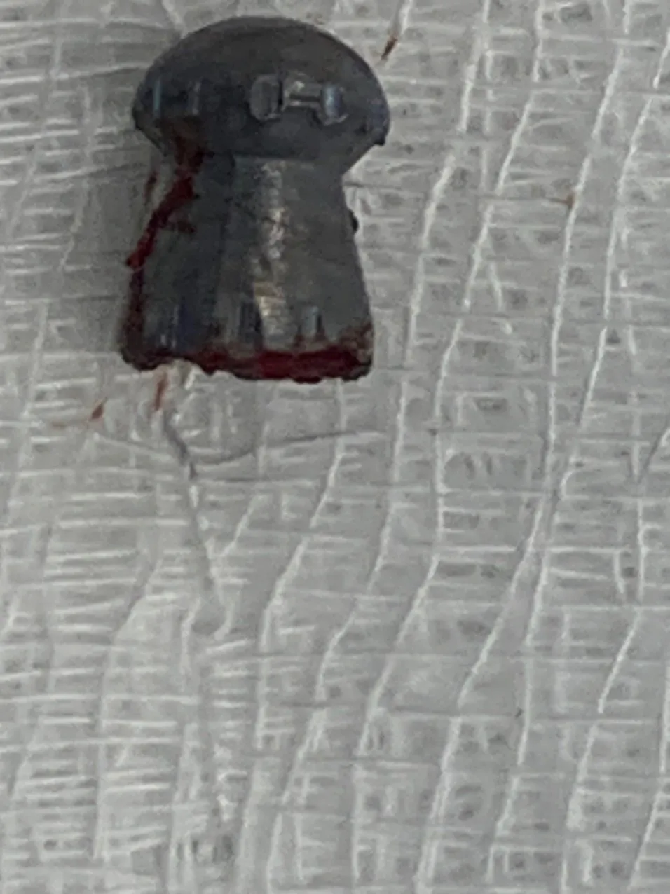 Thanh niên đi làm đồng bất ngờ bị trúng đạn xuyên dương vật ảnh 2