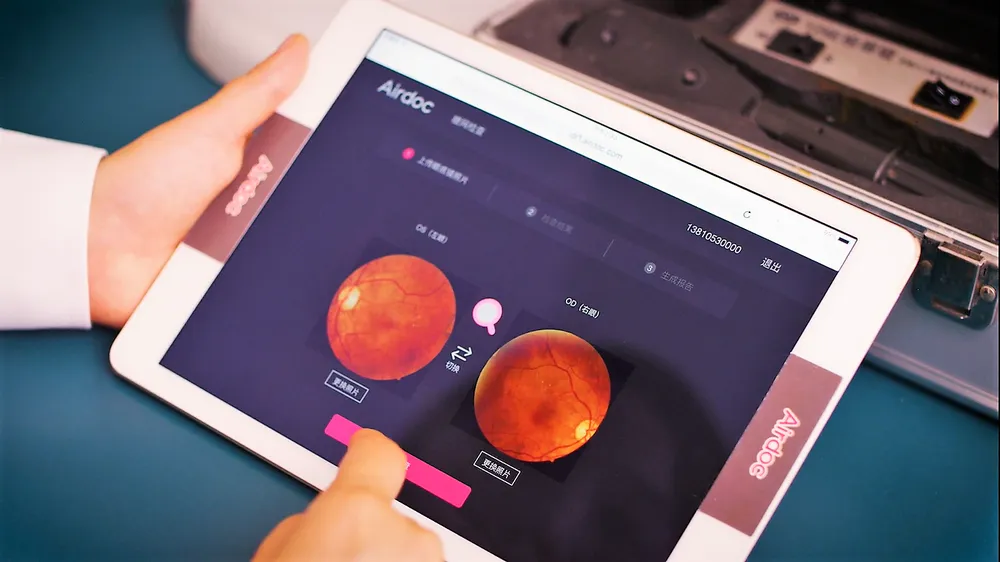 Sử dụng AI để phân tích những hình ảnh chụp võng mạc ở mặt sau của mỗi nhãn cầu