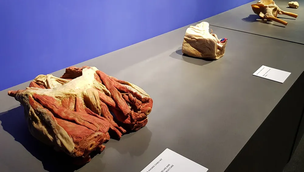 Yêu cầu báo cáo về triển lãm cơ thể con người đang gây tranh cãi ảnh 1