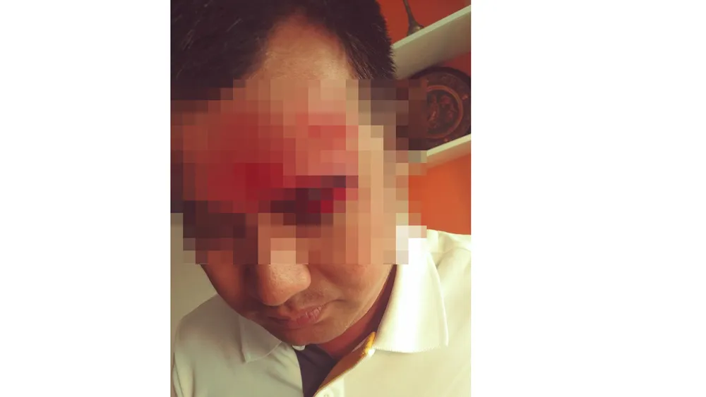 Ông Thiện bị nhóm người lạ đánh trọng thương tại  trụ sở Công ty cổ phần Đầu tư Thương mại và Dịch vụ Việt Úc 