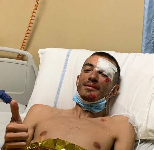 Tay đua xe đạp giải Giro d’Italia bị tai nạn vì… máy bay trực thăng ảnh 1