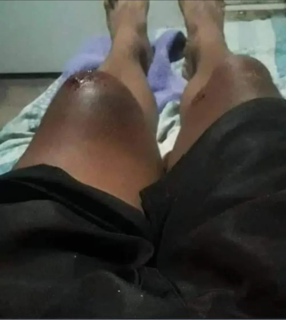 Tai nạn ngộ nghĩnh khiến tay đua Argentina trở thành “người nhím” ảnh 2