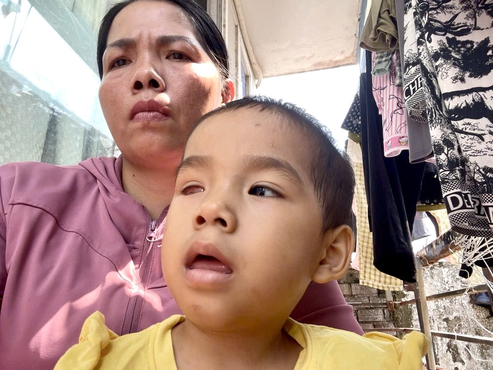 何氏娇兄和患眼疾女儿郑柯儿。