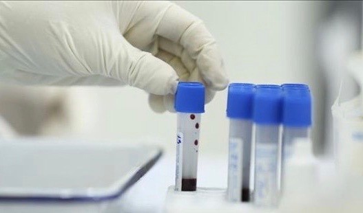 First community Omicron case recorded in Hanoi ảnh 2