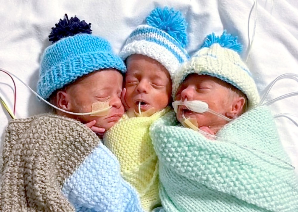 同卵三胞胎麟儿机率仅２亿份之一