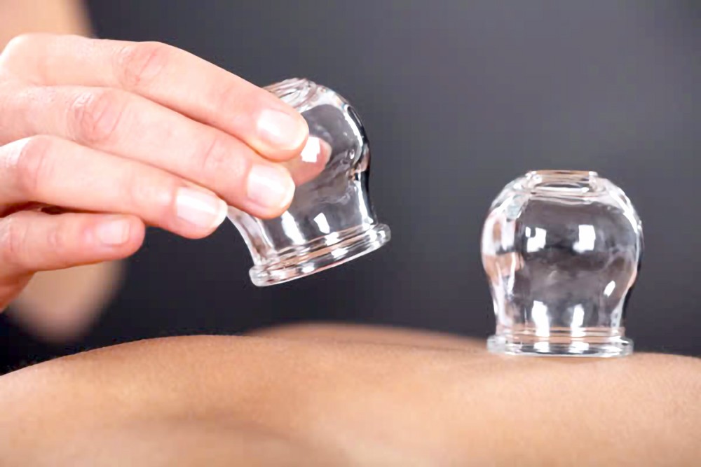 拔火罐不是人人都适合。