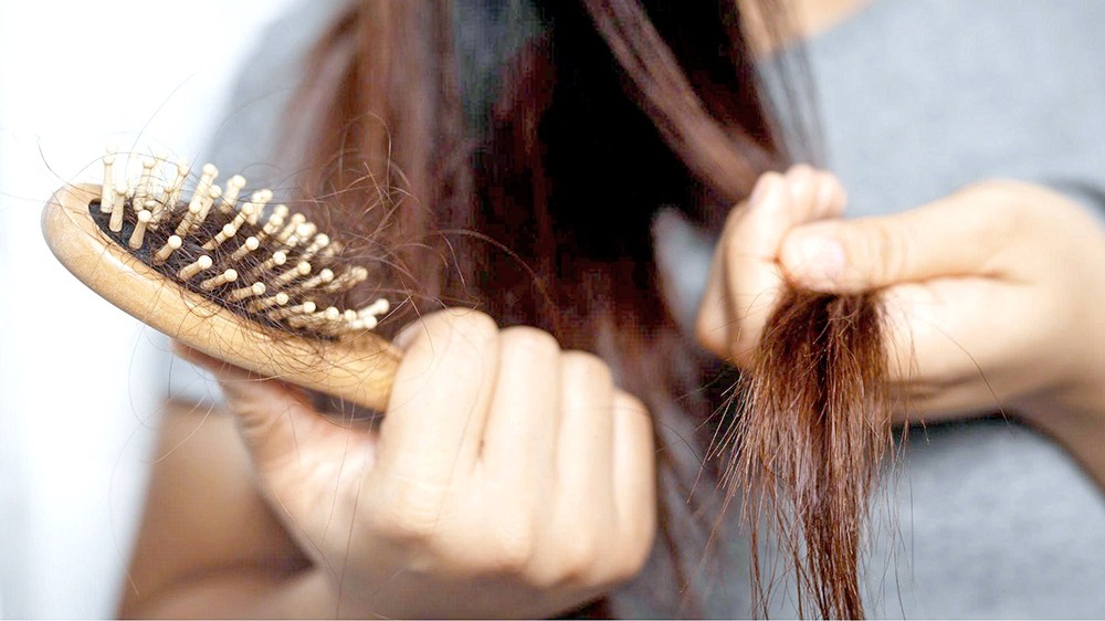 脱发是许多女人的烦恼。
