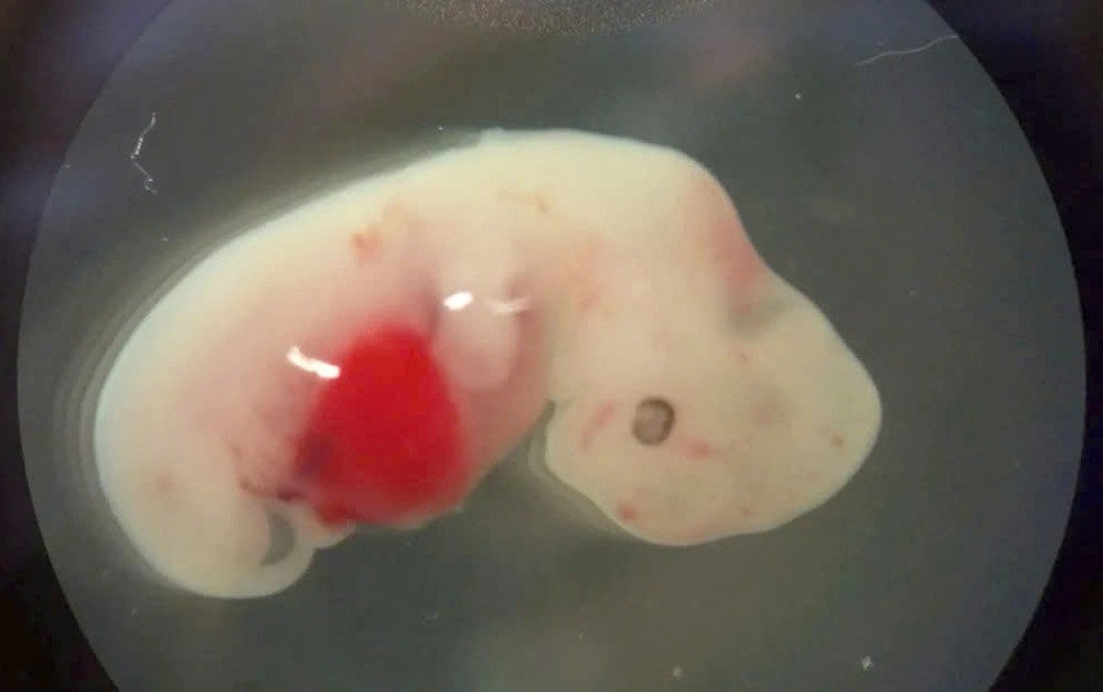 科学家成功培育出人猪嵌合心脏