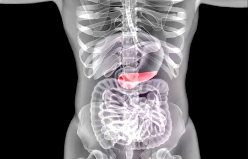 糖尿病患者的福音来了：3D列印成功制造功能性人类胰岛