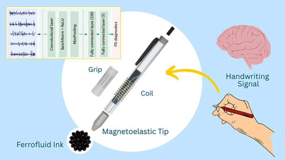 智能诊断笔：帕金森病早期检测的革命性突破
