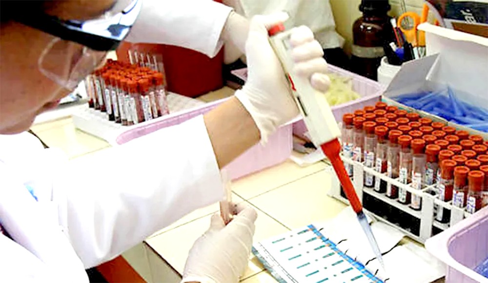 全球爱滋病防治面临资金断崖危机