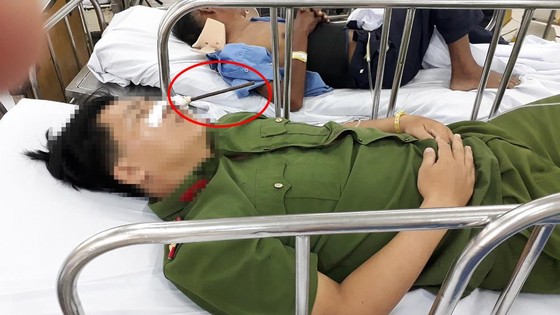 Cứu sống một nạn nhân bị thanh sắt đâm xuyên đầu ảnh 1