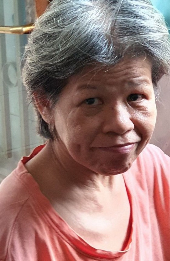 腦溢血致半身不遂 ảnh 1