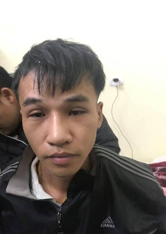 Phẫu thuật thay đổi hình dạng, nghi can trộm 200 cây vàng ở Bình Thuận vẫn không trốn thoát ảnh 1