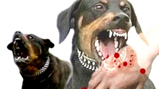 2 cháu bé tử vong vì chó dại cắn mà gia đình không hay biết ảnh 1