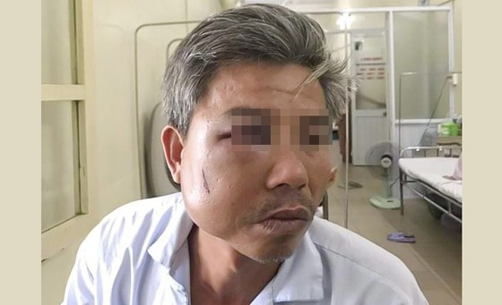 Khởi tố chủ quán cà phê Bố Già đánh trọng thương công nhân cây xanh ảnh 1