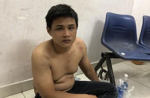 Bị truy đuổi, con nghiện cắn tay trinh sát hình sự thoát thân ảnh 2