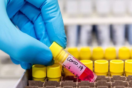 Phát hiện chủng virus SARS-CoV-2 ở Malaysia có khả năng lây nhiễm gấp 10 lần - Ảnh 1. Phát hiện chủng virus SARS-CoV-2 ở Malaysia có khả năng lây nhiễm gấp 10 lần - Ảnh 1.