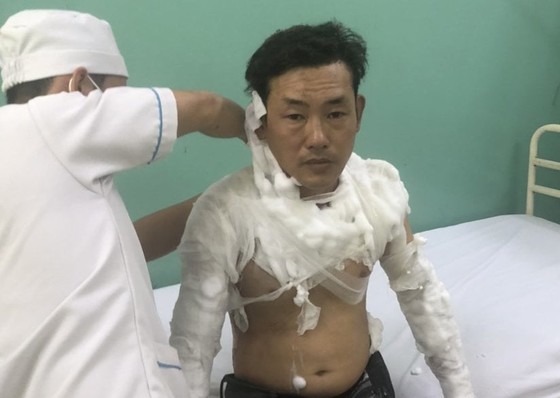 Công an thông tin vụ người đàn ông tẩm xăng xông vào cướp ngân hàng ảnh 2