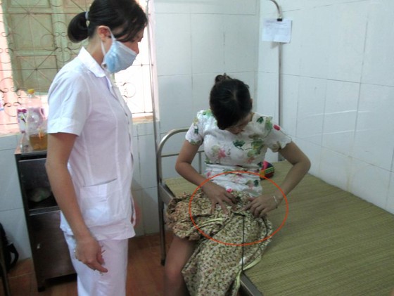 Ngáo đá, dùng nỏ bắn bị thương 3 người đi đường ảnh 1