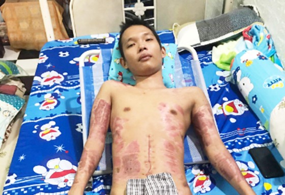 Bạn đọc tiếp tục giúp đỡ thanh niên bị tai nạn phải cắt bỏ 2 chân ảnh 2
