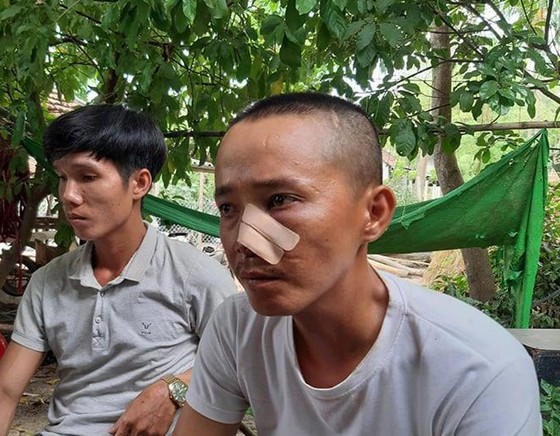Đoạt mạng hàng xóm chỉ vì mùi phân heo ảnh 1