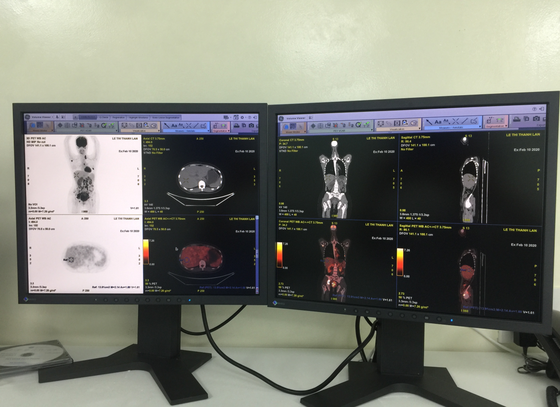 Bệnh viện Ung bướu TPHCM đưa vào hoạt động máy PET/CT trong chẩn đoán điều trị ung thư ảnh 1 Bệnh viện Ung bướu TPHCM đưa vào hoạt động máy PET/CT trong chẩn đoán điều trị ung thư ảnh 1