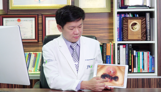 Một phụ nữ bị đứt lìa trụ mũi vì thẩm mỹ “dạo” ảnh 1