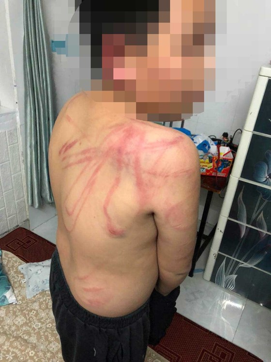 Cha ruột dùng dây lưng thắt cổ con trai 10 tuổi lôi xuống đường, bắt sủa tiếng chó ảnh 2