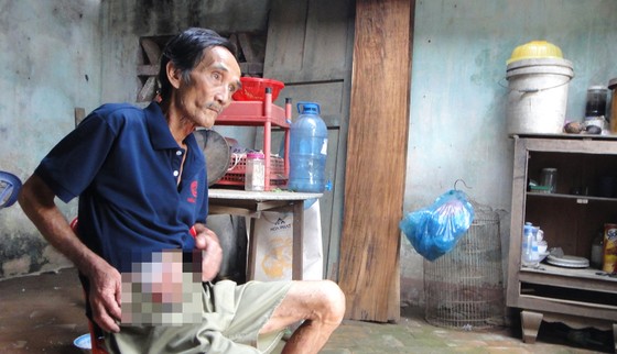 Ông Nguyễn Bảo Nhuận đang sống đơn độc trong căn nhà sắp sập, thân mang bệnh tật