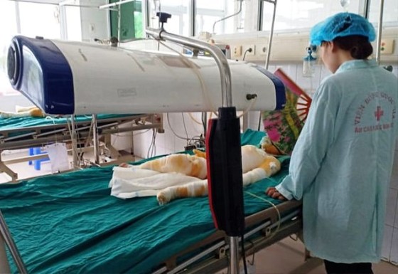 Vụ dạy “kỹ năng sống” khiến 3 trẻ bỏng nặng: Công an làm rõ trách nhiệm những người liên quan ảnh 2