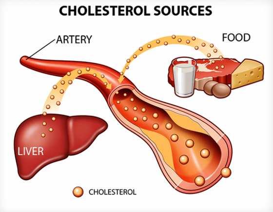 Báo động tình trạng người Việt Nam bị thừa Cholesterol ảnh 2