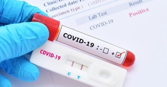 Đề nghị các tỉnh thành lập đoàn kiểm tra việc mua bán các loại xét nghiệm Covid-19 ảnh 1