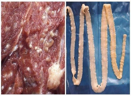 Người phụ nữ bị nhiễm loại ký sinh trùng do ăn bò tái ảnh 1