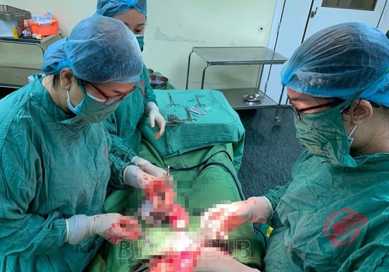 Cực hiếm gặp sản phụ mang thai đôi ở 2 tử cung khác nhau được mổ đẻ thành công ảnh 1