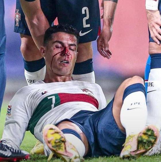 Ronaldo có một ngày khốn khổ, nhưng Bồ Đào Nha vẫn thắng lớn ảnh 1