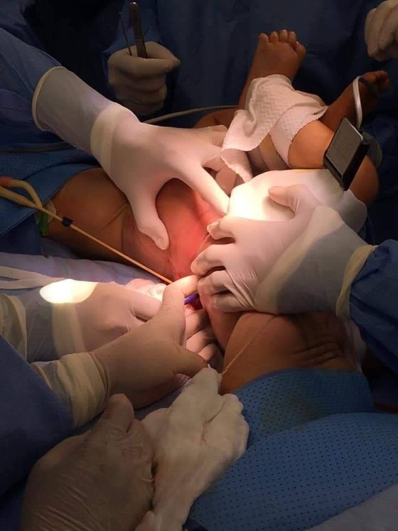 Trúc Nhi - Diệu Nhi được đưa ra khỏi phòng mổ ảnh 5