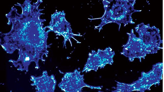 Protein kích thích sự phát triển của khối u ung thư