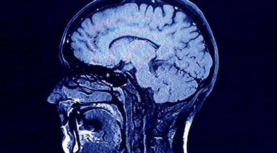 Nghiên cứu giúp hiểu rõ hơn về phát triển não bộ ở con người