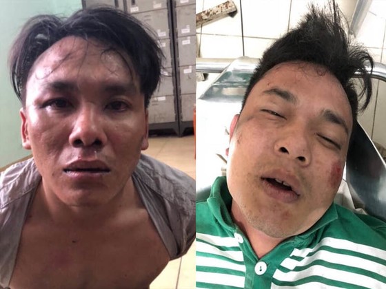 Bị truy bắt, nhóm cướp dùng mã tấu chém công an ảnh 1