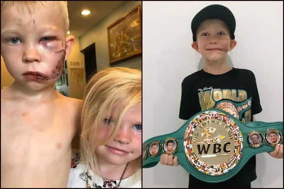 Cậu bé Briger Walker cứu em gái khỏi chó dữ và đai vô địch WBC hạng cân "Bridger"