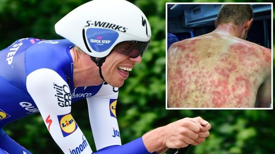 Criterium du Dauphine: Mưa đá bất ngờ ở chặng 2, một số tay đua sưng hết mình mẩy ảnh 1