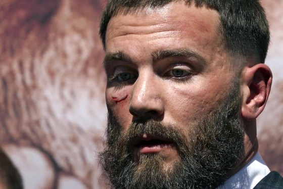 Canelo Alvarez vs Caleb Plant: Tháng 11 mới chính thức so quyền, nhưng đã kịp “triết chiêu” khiến Caleb rách mặt ảnh 5