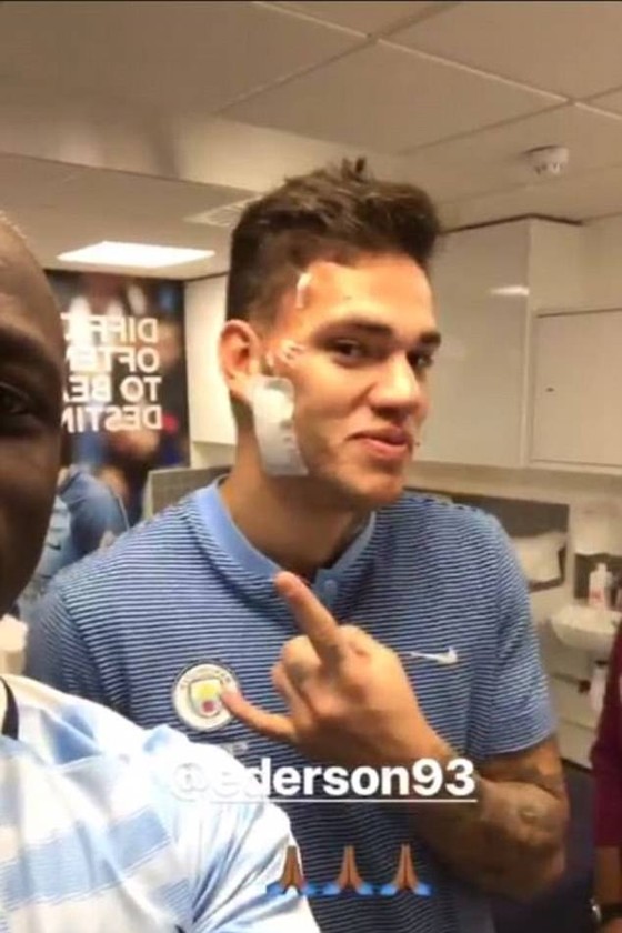 Pha bóng Mane khiến Ederson bất tỉnh ảnh 1