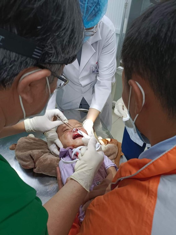 Làm rõ vụ người dân tố CSGT đánh cháu bé 3 tuổi nứt xương mặt ảnh 1