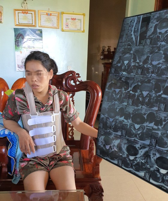 Khởi tố vụ một phụ nữ bị hành hung dã man suốt 11 năm ảnh 1