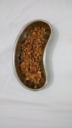 Bé trai 11 tuổi bị tắc hậu môn do nuốt hơn 70 gram hạt sơ ri ảnh 2
