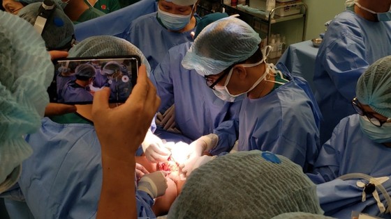 Trúc Nhi - Diệu Nhi được đưa ra khỏi phòng mổ ảnh 8 Trúc Nhi - Diệu Nhi được đưa ra khỏi phòng mổ ảnh 8