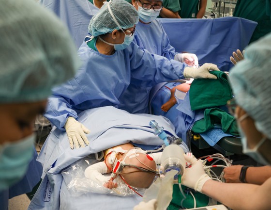 Trúc Nhi - Diệu Nhi được đưa ra khỏi phòng mổ ảnh 3 Trúc Nhi - Diệu Nhi được đưa ra khỏi phòng mổ ảnh 3